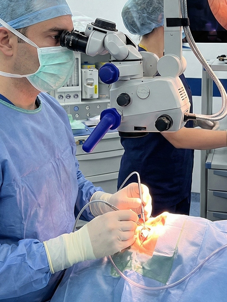 Operacije ablacije retine – vitreoretinalna hirurgija